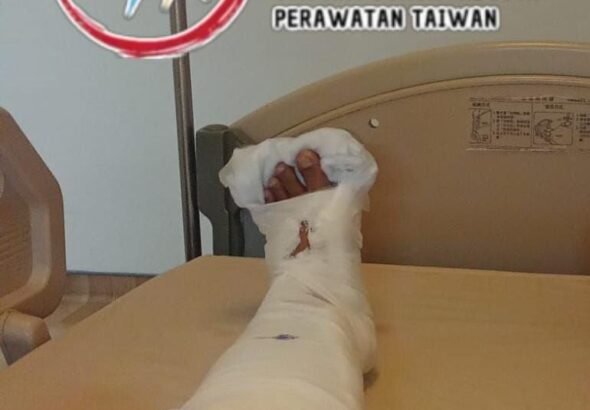 Yuni, saat terbaring di Far Eastern Memorial Hospital Taipei. (Sumber Foto : SBIPT).