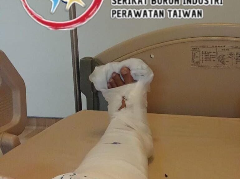 Yuni, saat terbaring di Far Eastern Memorial Hospital Taipei. (Sumber Foto : SBIPT).