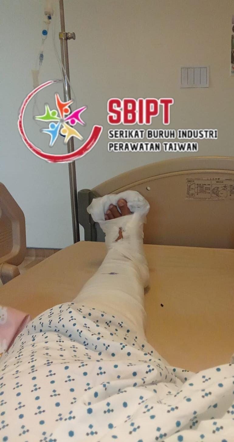 Yuni, saat terbaring di Far Eastern Memorial Hospital Taipei. (Sumber Foto : SBIPT).