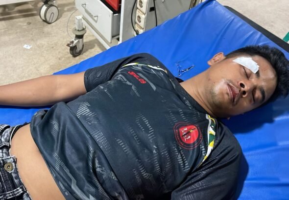 Dua personel Satuan Brimob Polda Banten mengalami luka serius setelah menjadi korban pengeroyokan dan pembacokan Debt collector di jl raya Serang. FOTO: Achie06/PORTALBMI.ID