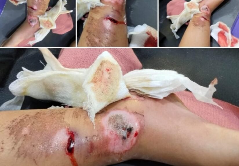 Keluarga Muhammad Ilham (6), bocah yang mengalami patah tulang pada kaki kanan akibat kecelakaan lalu lintas. FOTO: Budi05/PORTALBMI.ID