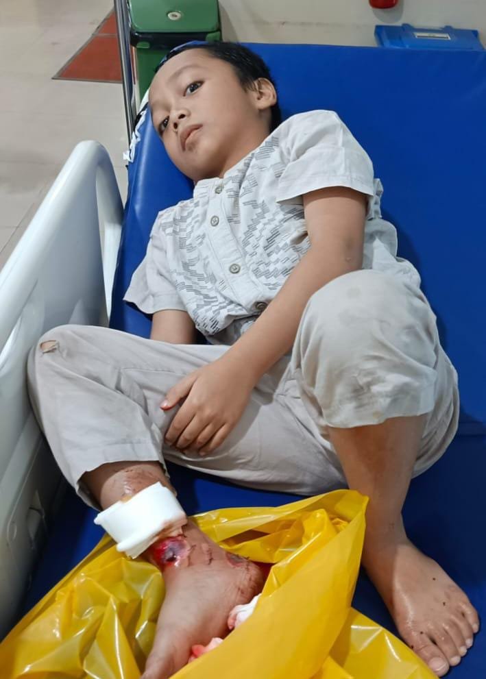 Keluarga Muhammad Ilham (6), bocah yang mengalami patah tulang pada kaki kanan akibat kecelakaan lalu lintas. FOTO: Budi05/PORTALBMI.ID